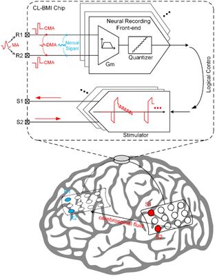 Anti-artifacts techniques for neural recording front-ends in closed-loop brain-machine interface ICs